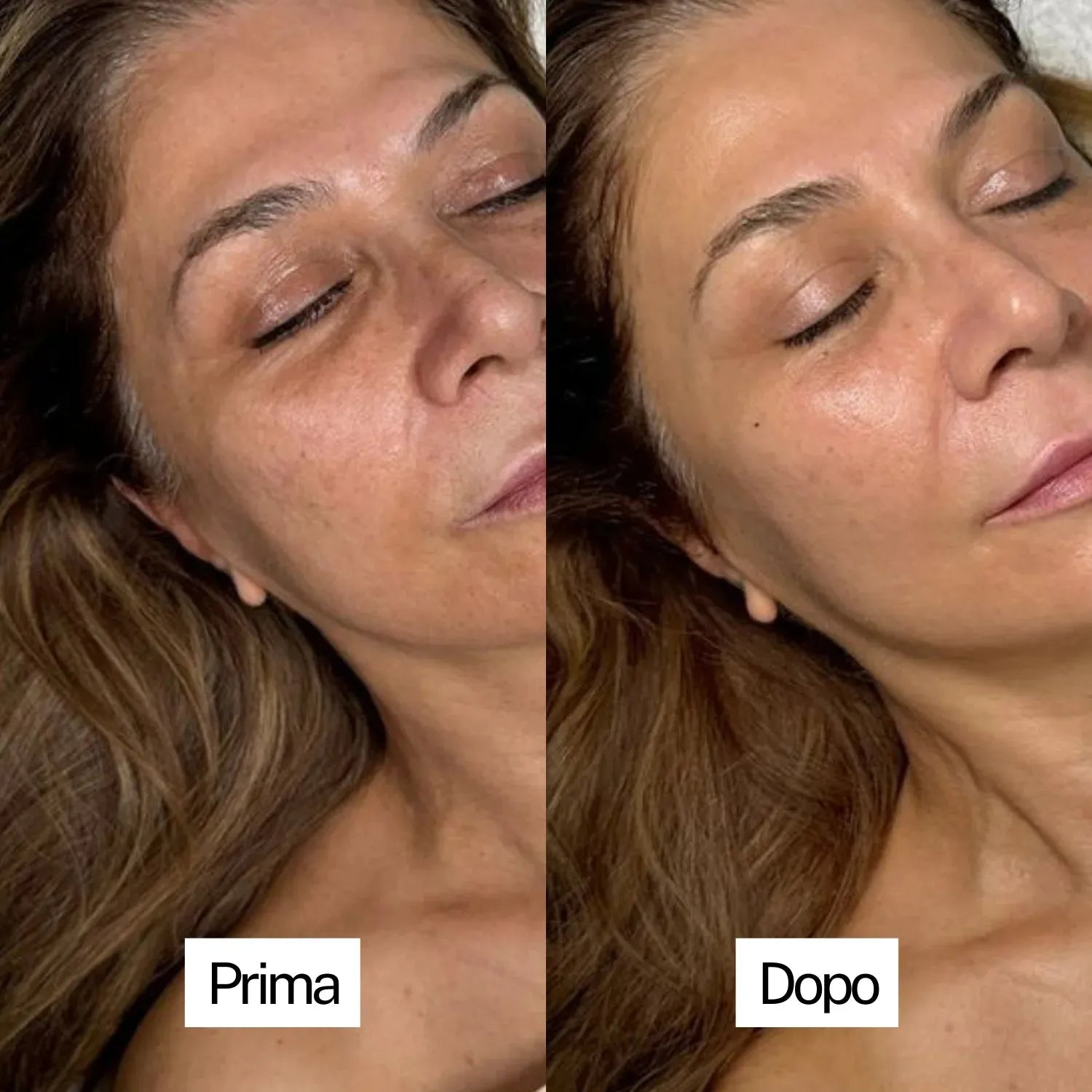 Soavia™ PureSkin – Addio punti neri, benvenuta pelle radiosa