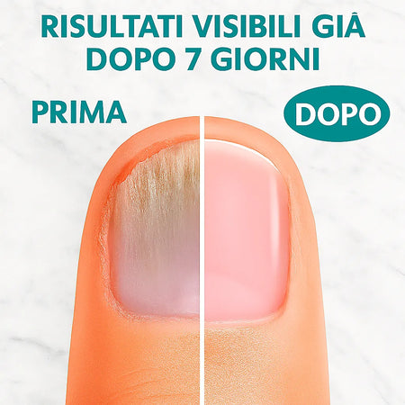 Soavia™ PureNails – Dimentica le unghie rovinate, ritrova la tua serenità